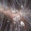 头止痒最有效的方法(01/04)
